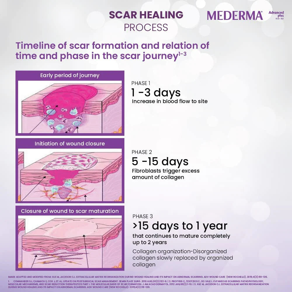 Mederma Advanced Plus Scar Gel -5 gm Mytrendzcart