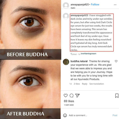 Buddha Natural Dark Circle Eye Serum -10 ml Mytrendzcart